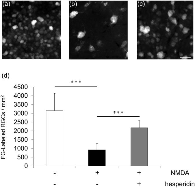 https://cdn.ncbi.nlm.nih.gov/pmc/blobs/709c/5537259/7086e9def356/41598_2017_6969_Fig4_HTML.jpg