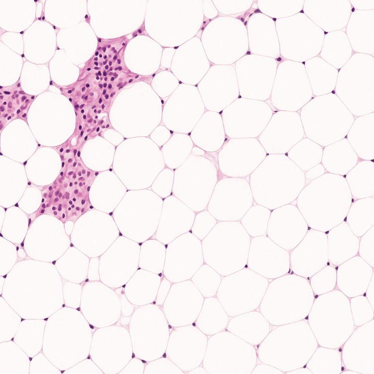 https://cdn.ncbi.nlm.nih.gov/pmc/blobs/70a3/12318370/19526b19de51/cureus-0017-00000087271-i02.jpg