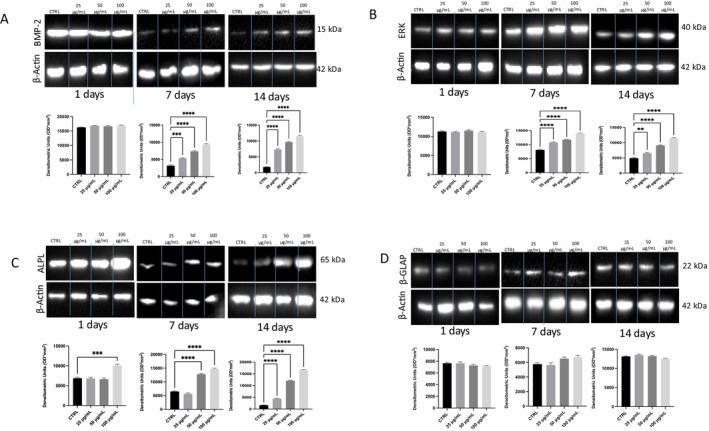 https://cdn.ncbi.nlm.nih.gov/pmc/blobs/70aa/12358679/6e4501151197/FSN3-13-e70785-g007.jpg