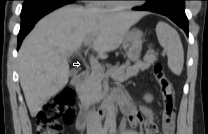 https://cdn.ncbi.nlm.nih.gov/pmc/blobs/70b2/8314797/fe693e8481a9/gr1_lrg.jpg