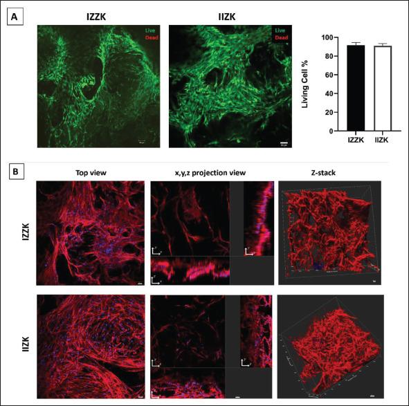 https://cdn.ncbi.nlm.nih.gov/pmc/blobs/70b9/10261150/a52f613a8236/IJB-9-4-719-g003.jpg