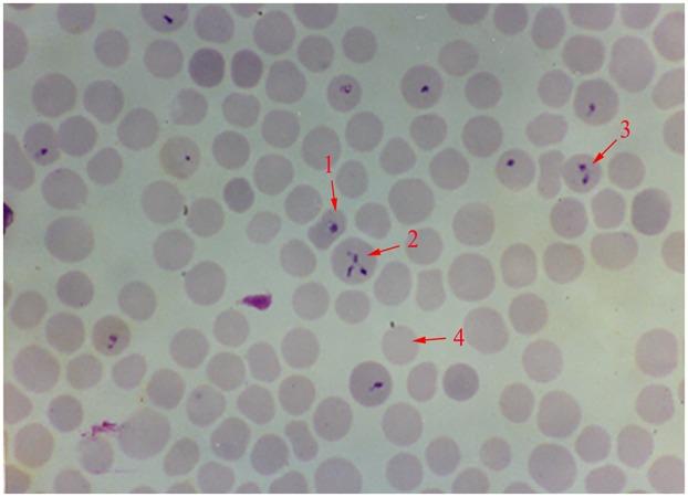 https://cdn.ncbi.nlm.nih.gov/pmc/blobs/70ba/5509917/bac218e8ef0e/fmicb-08-01323-g001.jpg