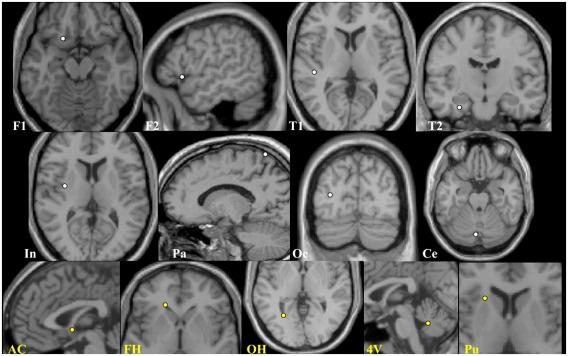 https://cdn.ncbi.nlm.nih.gov/pmc/blobs/70bb/3223520/be8c1a5b75c7/gr3.jpg