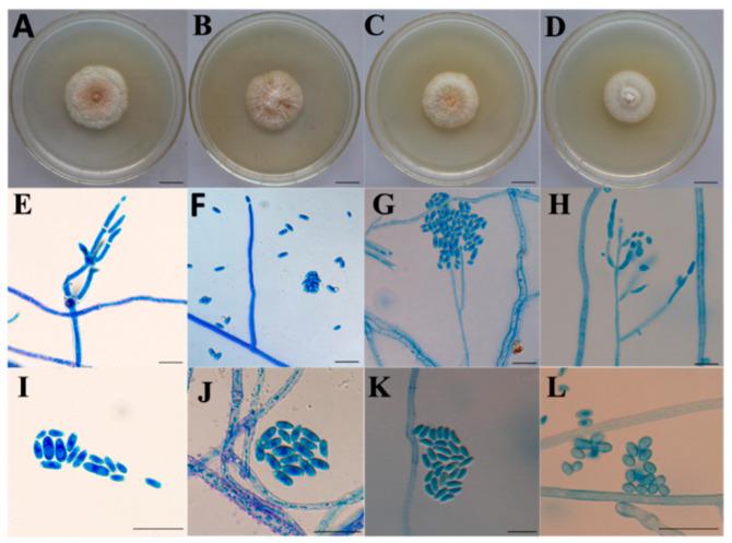 https://cdn.ncbi.nlm.nih.gov/pmc/blobs/70bf/8197242/9b64285f202f/ijms-22-05530-g001.jpg