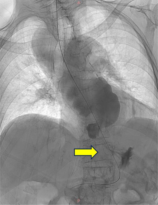 https://cdn.ncbi.nlm.nih.gov/pmc/blobs/70c2/12320524/4d2507e84340/gr2.jpg