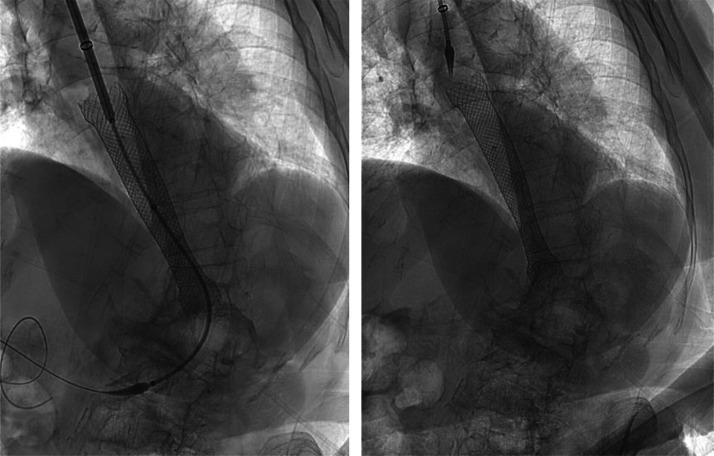 https://cdn.ncbi.nlm.nih.gov/pmc/blobs/70c2/12320524/f0c0164658d0/gr4.jpg