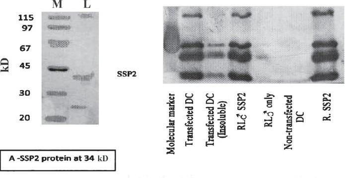 https://cdn.ncbi.nlm.nih.gov/pmc/blobs/70c6/3249966/c78f39e91482/IJMR-134-672-g005.jpg