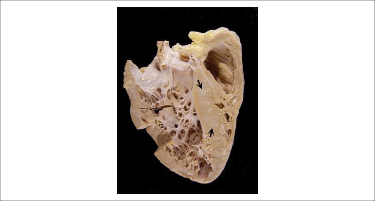 https://cdn.ncbi.nlm.nih.gov/pmc/blobs/70c9/6777885/4b4fc5438b76/abc-113-02-0286-g06.jpg