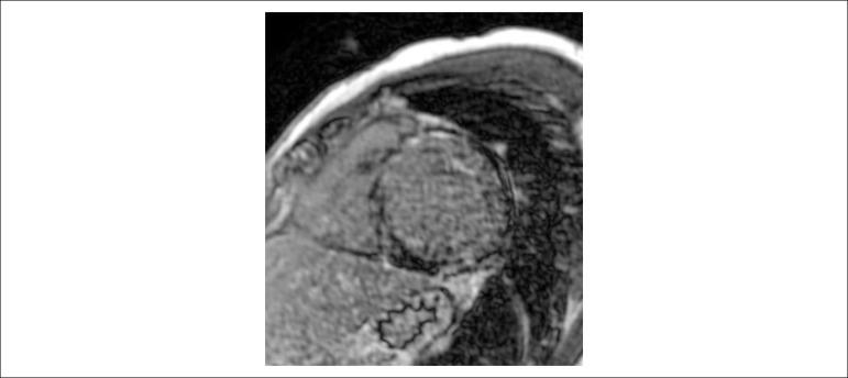 https://cdn.ncbi.nlm.nih.gov/pmc/blobs/70c9/6777885/71615be3bab7/abc-113-02-0286-g04.jpg