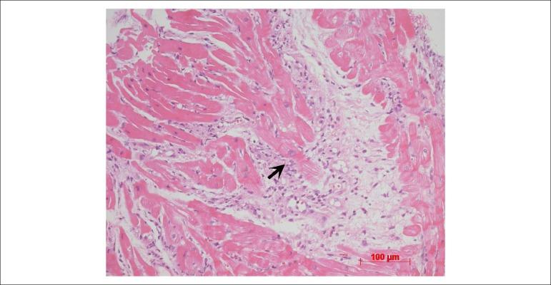 https://cdn.ncbi.nlm.nih.gov/pmc/blobs/70c9/6777885/84425984c8db/abc-113-02-0286-g09.jpg