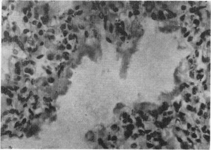 https://cdn.ncbi.nlm.nih.gov/pmc/blobs/70ca/2012602/1c3cab8cd296/archdisch01608-0046-b.jpg
