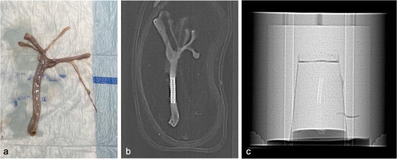 https://cdn.ncbi.nlm.nih.gov/pmc/blobs/70ce/10130245/b70aa54af602/41747_2023_333_Fig1_HTML.jpg