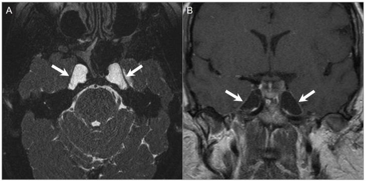 https://cdn.ncbi.nlm.nih.gov/pmc/blobs/70cf/10366931/04bbd9891c02/tomography-09-00097-g027.jpg