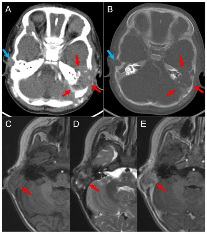 https://cdn.ncbi.nlm.nih.gov/pmc/blobs/70cf/10366931/5865355f0da9/tomography-09-00097-g017.jpg