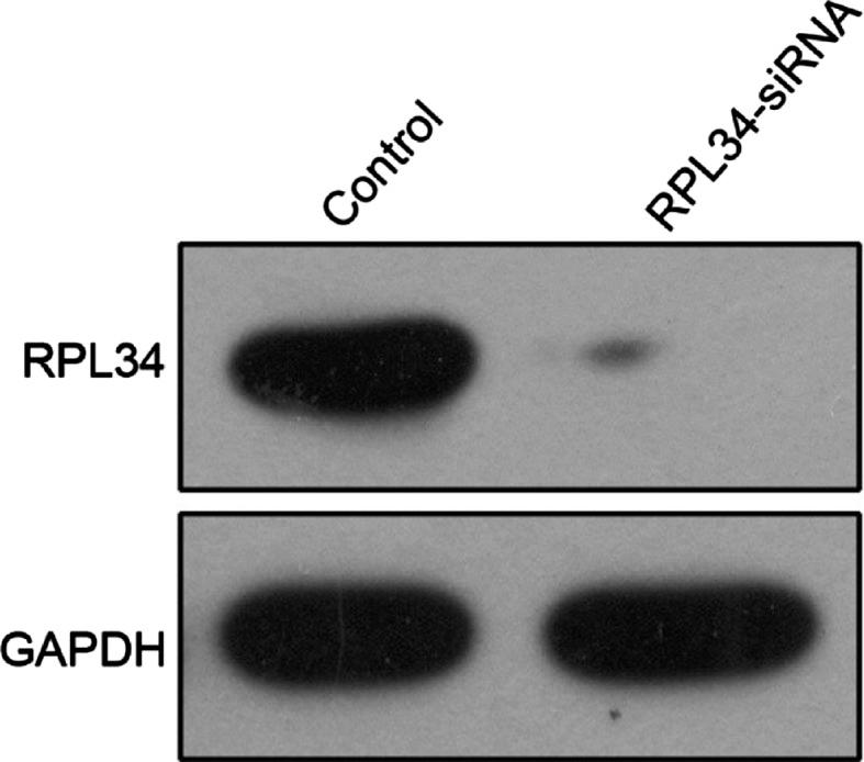 https://cdn.ncbi.nlm.nih.gov/pmc/blobs/70d0/4583519/8af0b7ec2de7/OR-34-05-2267-g01.jpg