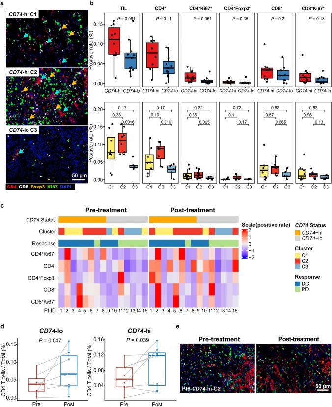 https://cdn.ncbi.nlm.nih.gov/pmc/blobs/70d3/10992620/62faf96b2e5d/262_2023_3604_Fig4_HTML.jpg