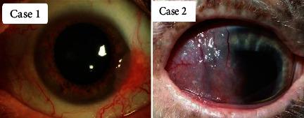 https://cdn.ncbi.nlm.nih.gov/pmc/blobs/70d4/9588326/6c7fd1dc73b4/DM2022-5427579.001.jpg