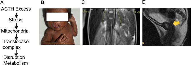 https://cdn.ncbi.nlm.nih.gov/pmc/blobs/70d5/6499912/a55e03a65875/EDM19-0009fig1.jpg
