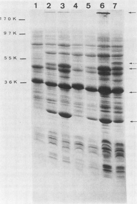 https://cdn.ncbi.nlm.nih.gov/pmc/blobs/70d8/261262/841ea91e4778/iai00117-0186-a.jpg
