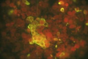 https://cdn.ncbi.nlm.nih.gov/pmc/blobs/70d8/7125561/25c18620c879/gr3.jpg