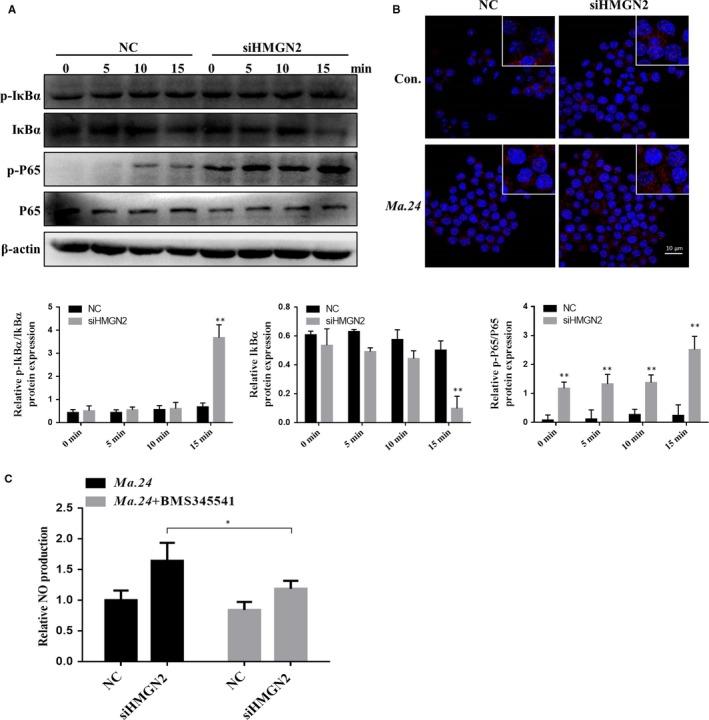 https://cdn.ncbi.nlm.nih.gov/pmc/blobs/70db/6850944/83f1c5e163ff/JCMM-23-7985-g005.jpg