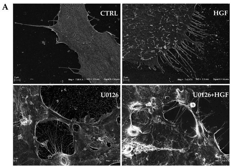 https://cdn.ncbi.nlm.nih.gov/pmc/blobs/70dc/10377482/177398d25c2f/biomedicines-11-01894-g006a.jpg