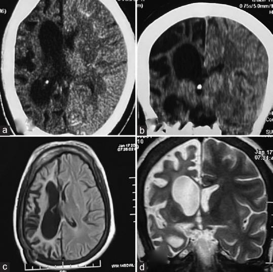 https://cdn.ncbi.nlm.nih.gov/pmc/blobs/70dd/10789462/82aba7bae804/IJABMR-13-259-g002.jpg