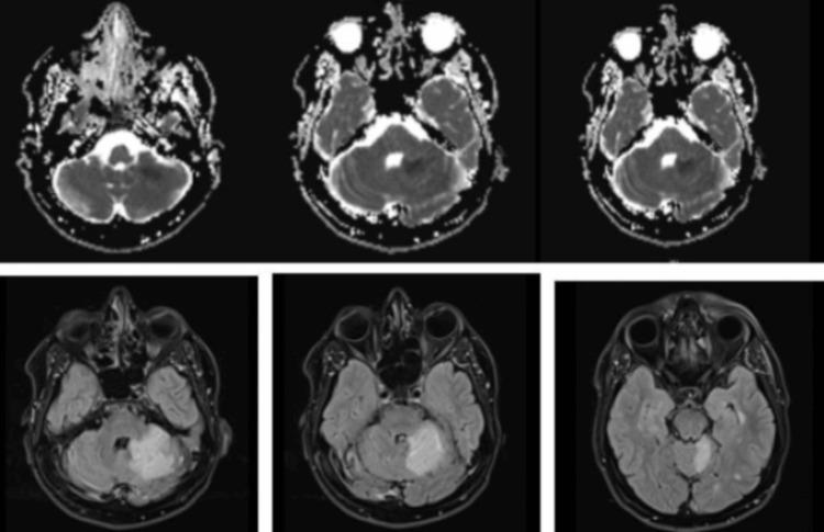 https://cdn.ncbi.nlm.nih.gov/pmc/blobs/70dd/11168737/5a2ab823450e/cureus-0016-00000060218-i01.jpg