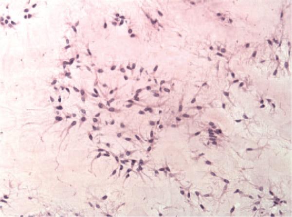 https://cdn.ncbi.nlm.nih.gov/pmc/blobs/70e1/4797241/2a69ceecc8a0/10.1177_1947603515621998-fig3.jpg