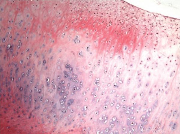 https://cdn.ncbi.nlm.nih.gov/pmc/blobs/70e1/4797241/46eeacc8b170/10.1177_1947603515621998-fig2.jpg