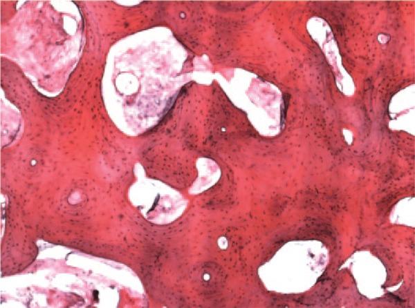 https://cdn.ncbi.nlm.nih.gov/pmc/blobs/70e1/4797241/6bee8f0358b3/10.1177_1947603515621998-fig4.jpg