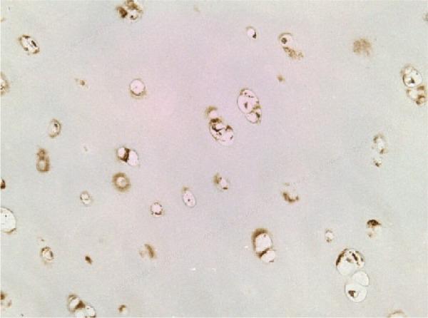 https://cdn.ncbi.nlm.nih.gov/pmc/blobs/70e1/4797241/a886ca654d5c/10.1177_1947603515621998-fig5.jpg