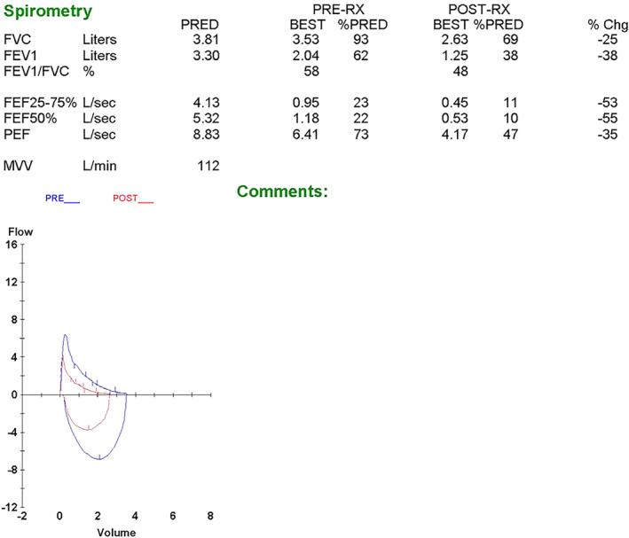 https://cdn.ncbi.nlm.nih.gov/pmc/blobs/70ea/7967704/eccebd8850b4/RCR2-9-e00698-g001.jpg