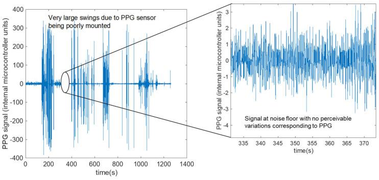 https://cdn.ncbi.nlm.nih.gov/pmc/blobs/70ef/10098585/6aa0c8f78027/sensors-23-03429-g002.jpg