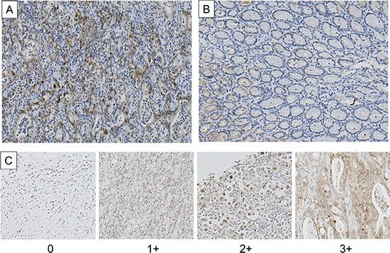 https://cdn.ncbi.nlm.nih.gov/pmc/blobs/70f1/4951298/0dd44e96a4f0/oncotarget-07-18415-g001.jpg