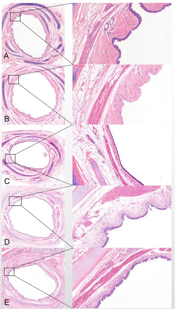 https://cdn.ncbi.nlm.nih.gov/pmc/blobs/70f8/7851571/a9e1557c2379/CTM2-11-e315-g003.jpg