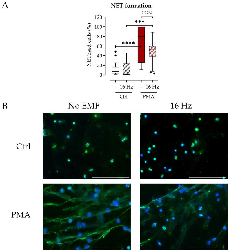 https://cdn.ncbi.nlm.nih.gov/pmc/blobs/70f9/10572227/c51f8f28c724/ijms-24-14629-g003.jpg