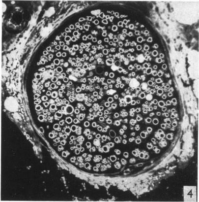 https://cdn.ncbi.nlm.nih.gov/pmc/blobs/70fb/1273214/988868d4e45a/janat00483-0057-d.jpg