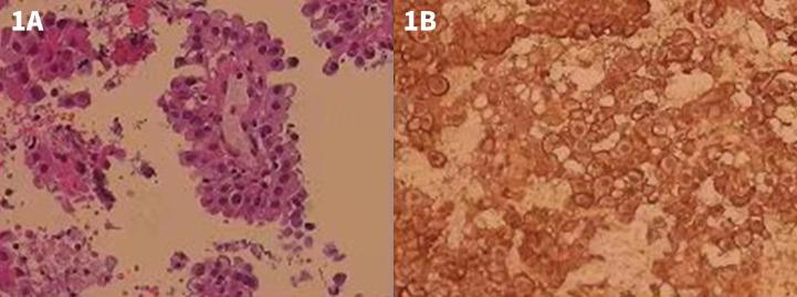 https://cdn.ncbi.nlm.nih.gov/pmc/blobs/70fd/10228747/a863ea0776b2/fonc-13-1153233-g001.jpg
