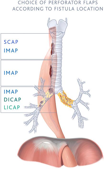 https://cdn.ncbi.nlm.nih.gov/pmc/blobs/7100/10859646/93aba8e351da/fx1.jpg