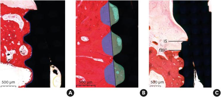 https://cdn.ncbi.nlm.nih.gov/pmc/blobs/7100/11377894/b383e5136ed0/jpis-54-280-g004.jpg