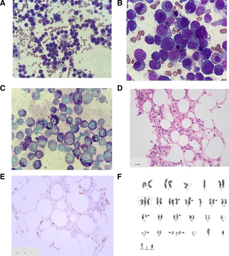 https://cdn.ncbi.nlm.nih.gov/pmc/blobs/7104/12073842/3a63f556339b/medi-104-e39766-g001.jpg