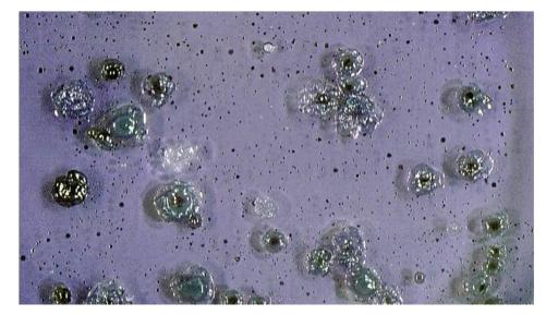 https://cdn.ncbi.nlm.nih.gov/pmc/blobs/7105/2967828/1d599dc405aa/CDI2011-681956.001.jpg
