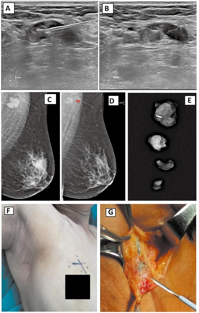 https://cdn.ncbi.nlm.nih.gov/pmc/blobs/7109/11188870/cd186d74074a/cm9-137-1421-g002.jpg