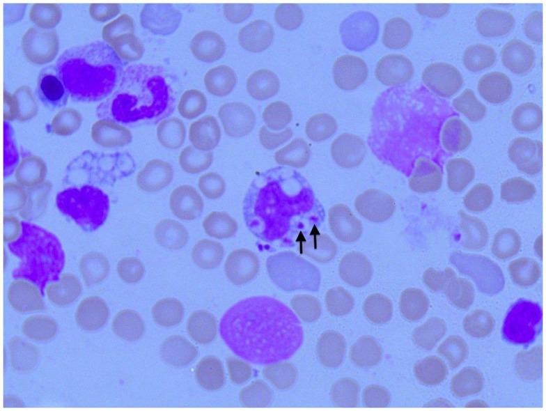 https://cdn.ncbi.nlm.nih.gov/pmc/blobs/7109/4483513/440bbf58b689/fped-03-00059-g002.jpg