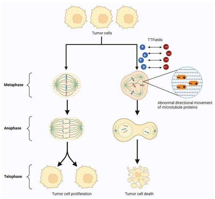 https://cdn.ncbi.nlm.nih.gov/pmc/blobs/710c/10705801/ecae80b90bde/cancers-15-05642-g001.jpg