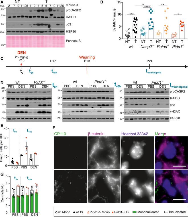 https://cdn.ncbi.nlm.nih.gov/pmc/blobs/7118/7726793/f526f4a8a46f/EMBR-21-e50893-g004.jpg