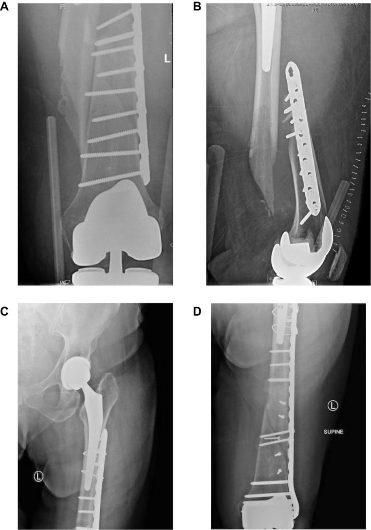 https://cdn.ncbi.nlm.nih.gov/pmc/blobs/711a/6754334/25b5683bdf04/ORR-11-119-g0003.jpg