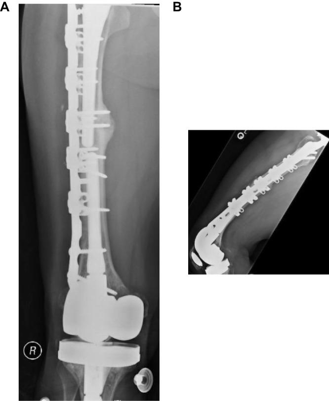 https://cdn.ncbi.nlm.nih.gov/pmc/blobs/711a/6754334/ecef5e48a63d/ORR-11-119-g0006.jpg