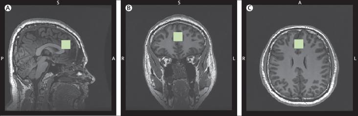 https://cdn.ncbi.nlm.nih.gov/pmc/blobs/7125/6162342/018d5f6f7bd5/gr1.jpg